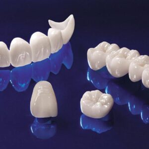 porselen-kaplama Porcelain Veneer